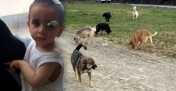 Ağrı'da köpeklerin saldırdığı çocuktan acı haber